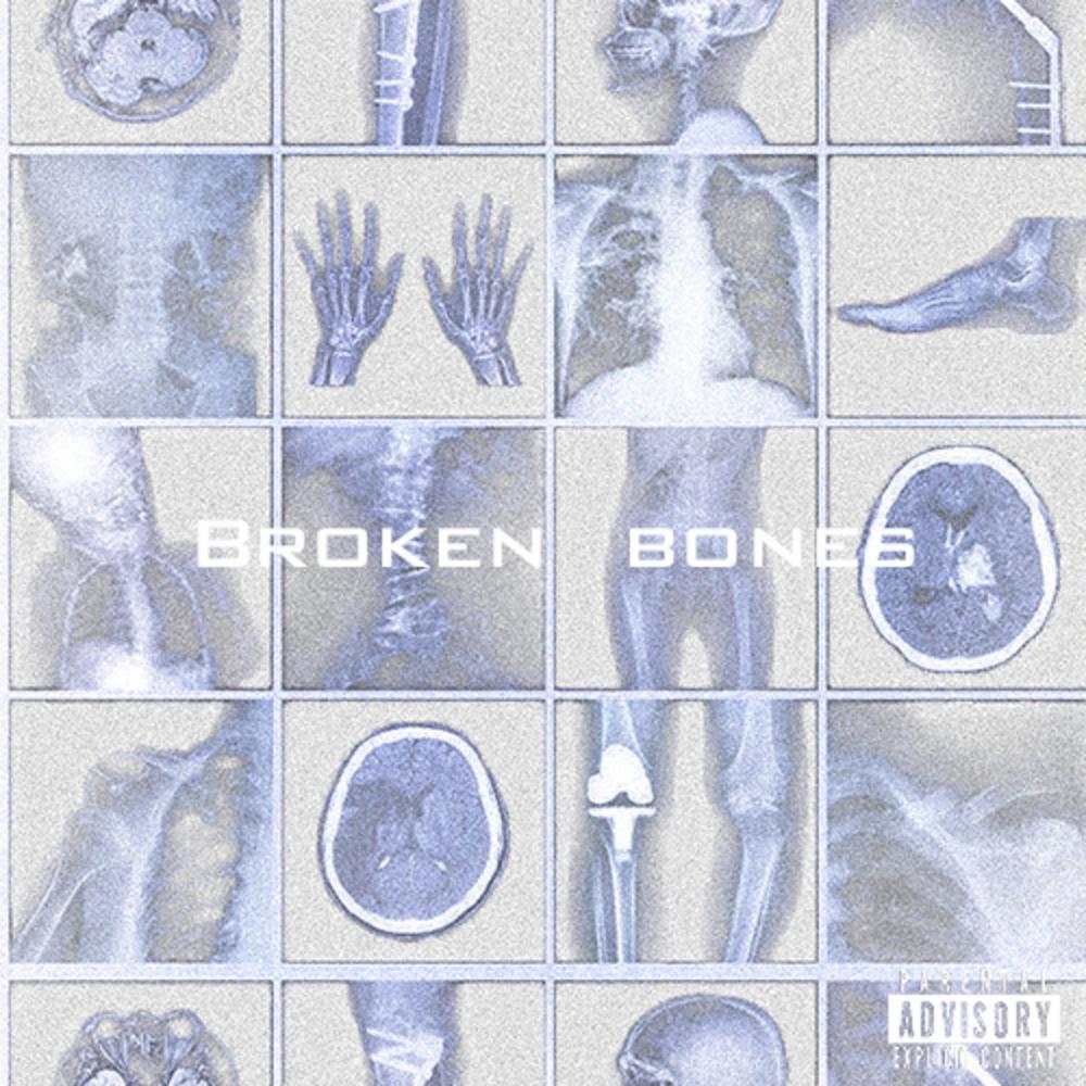 Broken Bones (Explicit)