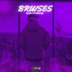 ดาวน์โหลดและฟังเพลง Bruises (Explicit) พร้อมเนื้อเพลงจาก Blue 4