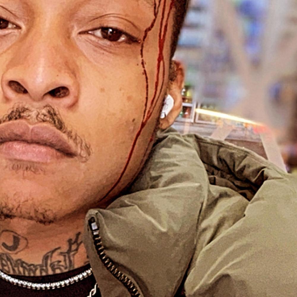 Pain in My Eyes (Explicit)