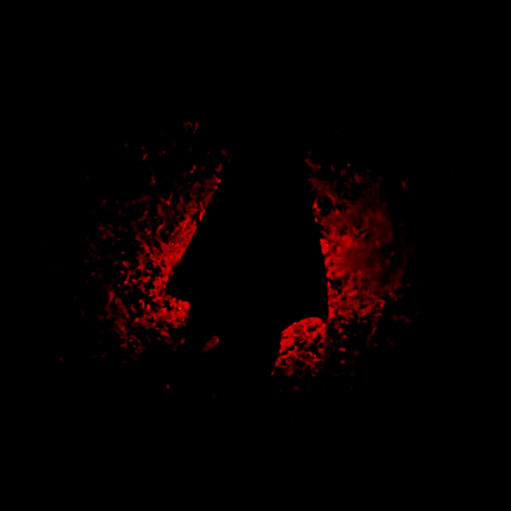 Watch It Burn (Redux)
