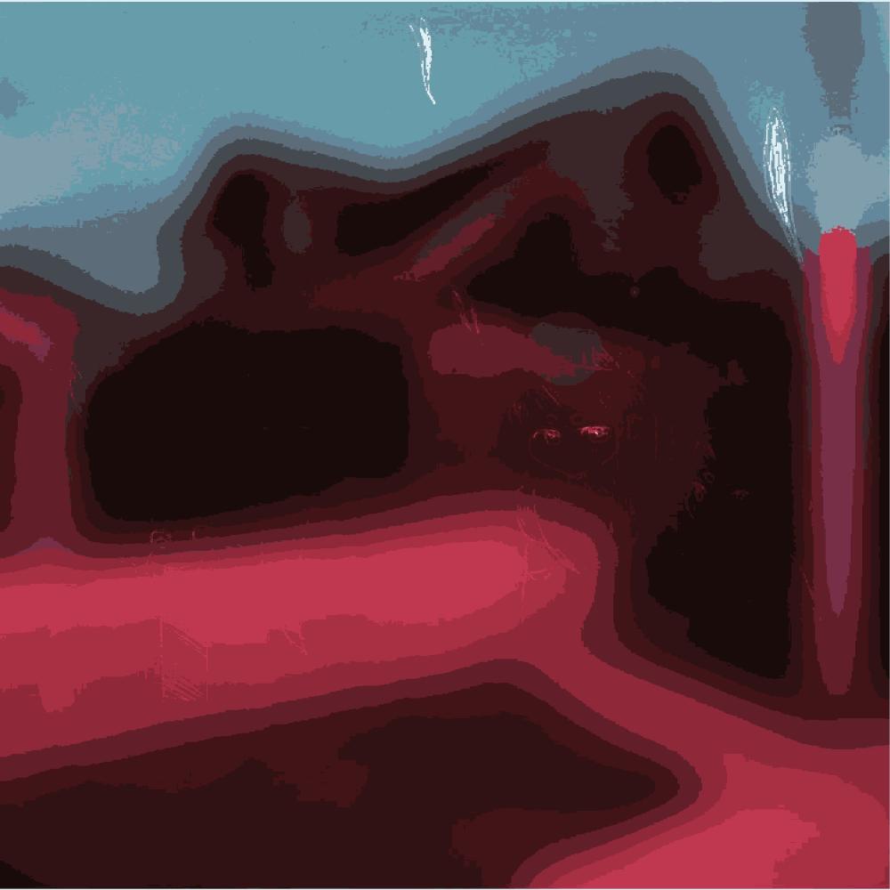 Retainer