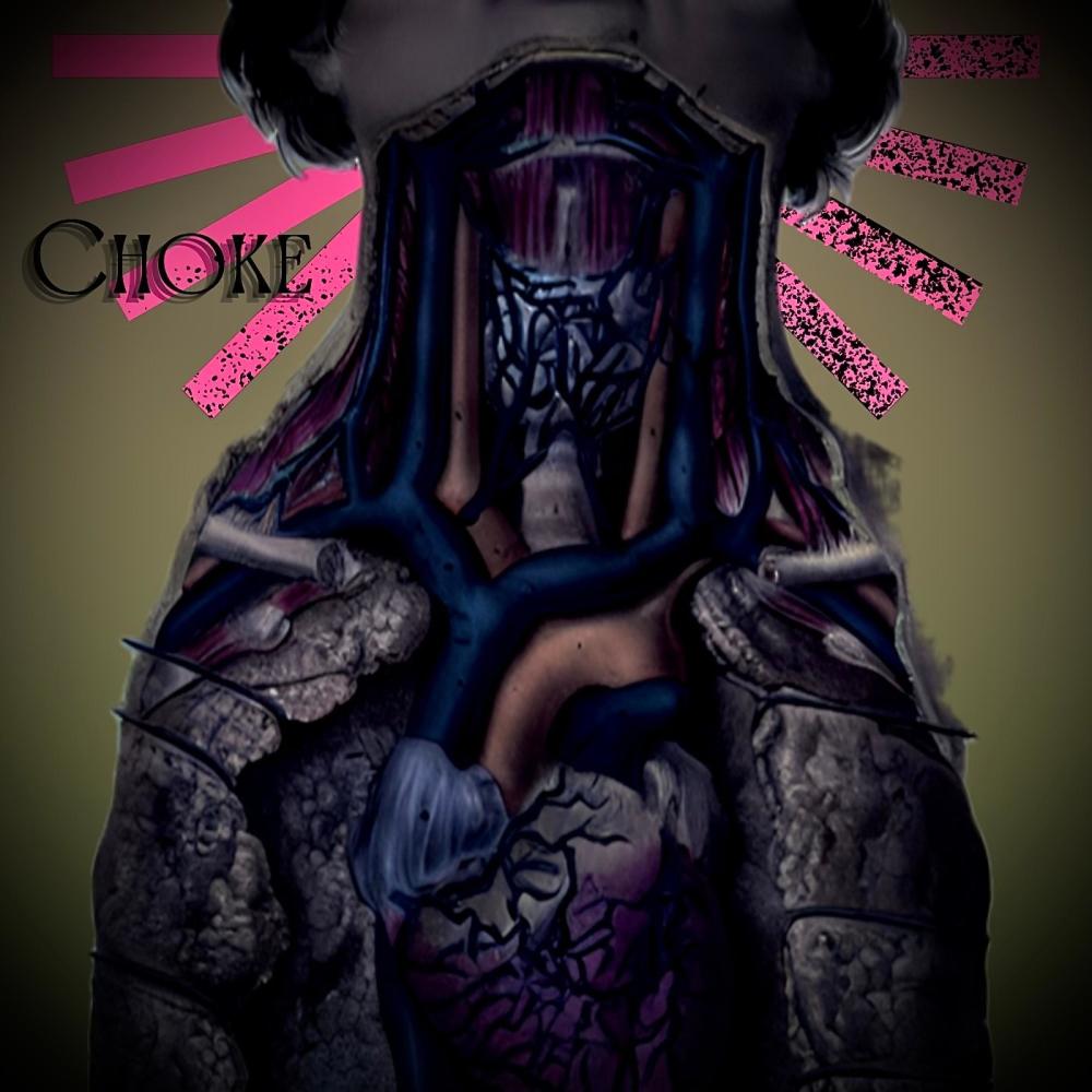 CHOKE