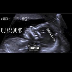 ดาวน์โหลดและฟังเพลง Ultrasound (Explicit) พร้อมเนื้อเพลงจาก Yrc2x