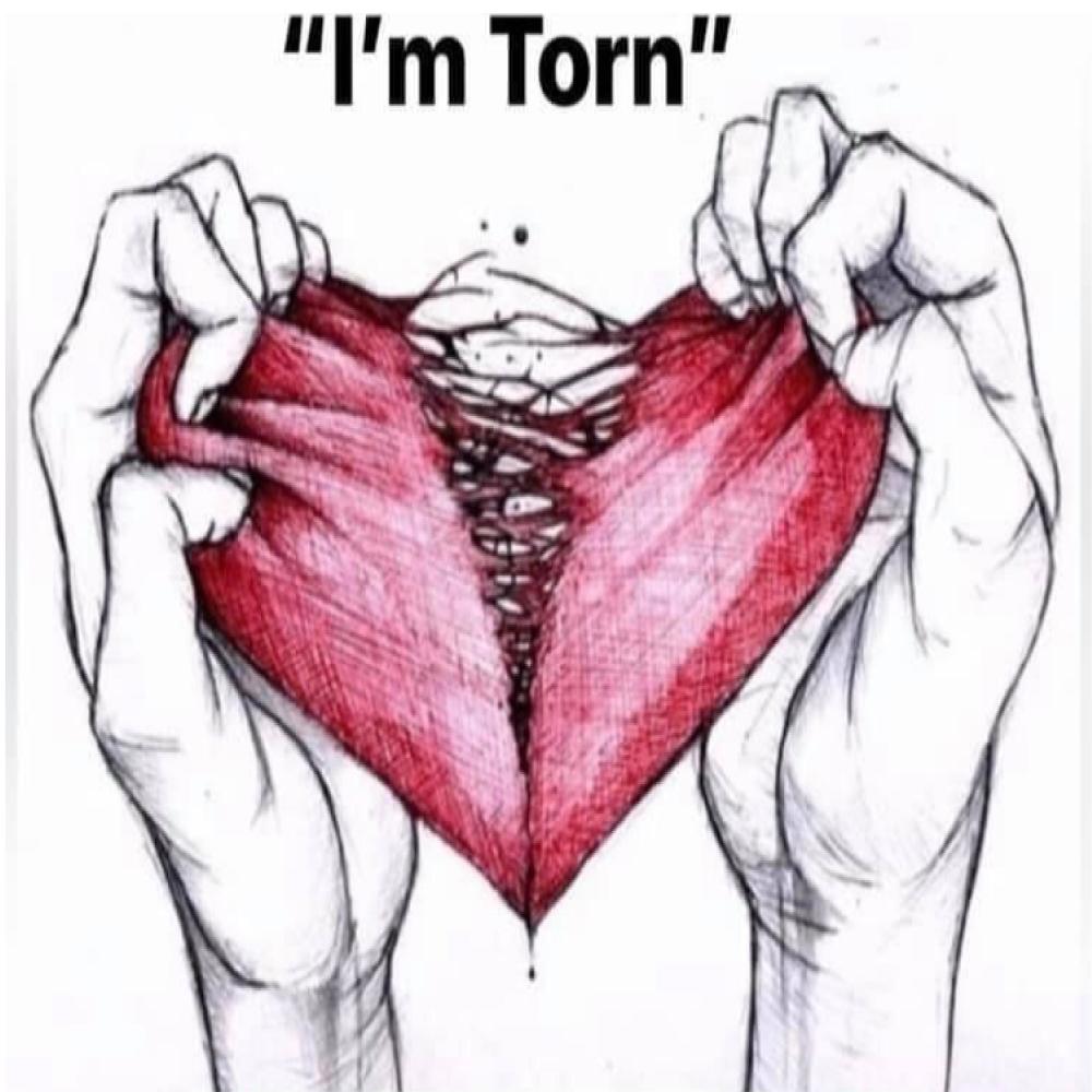 I'm Torn