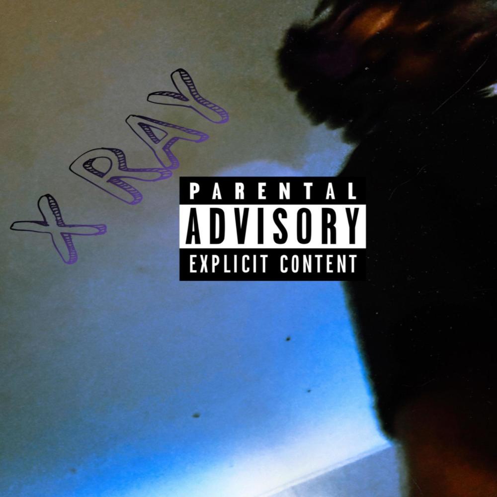 X Ray (Explicit)