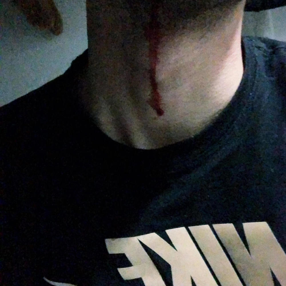 Iceusedtobesolid (Explicit)