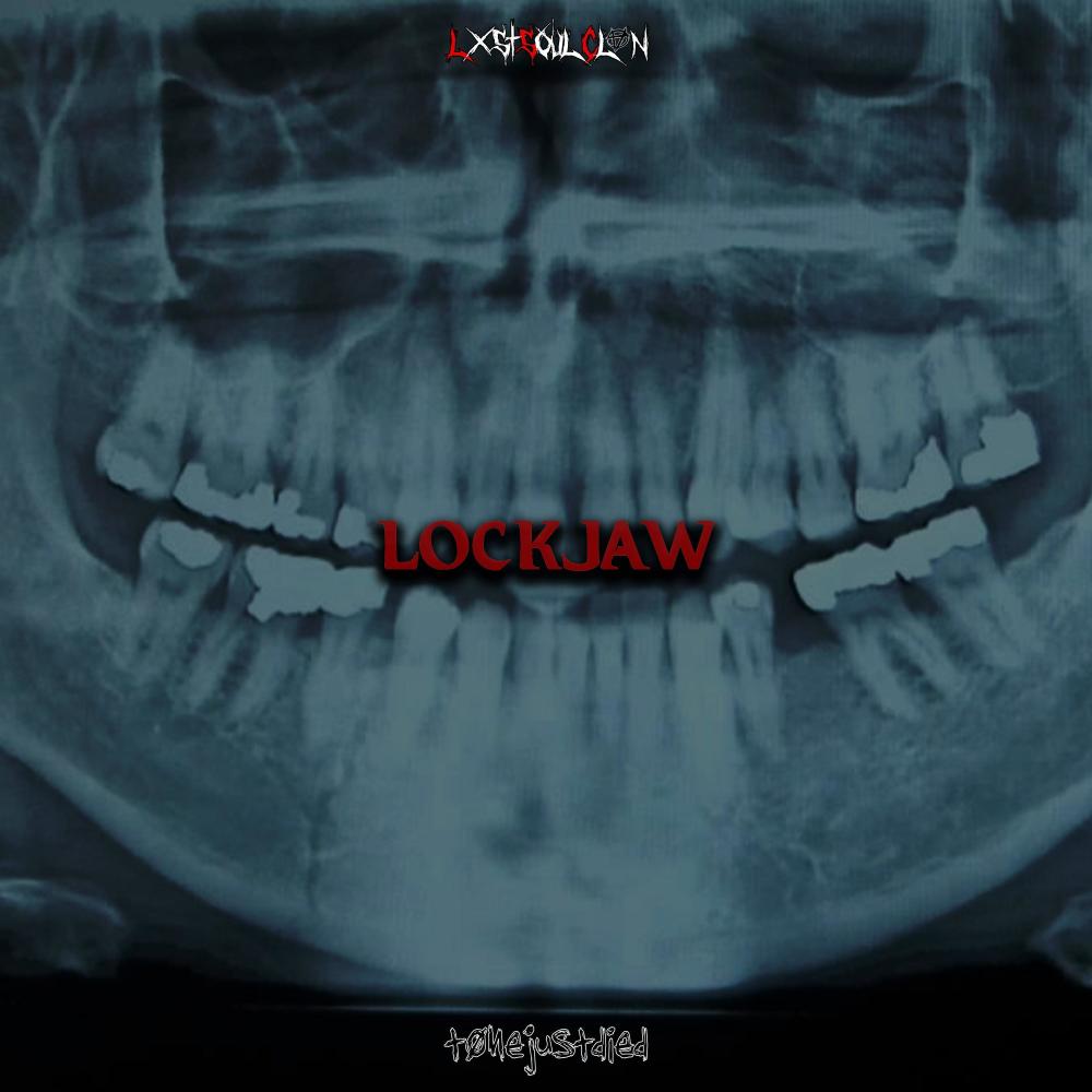 LOCKJAW (Explicit)