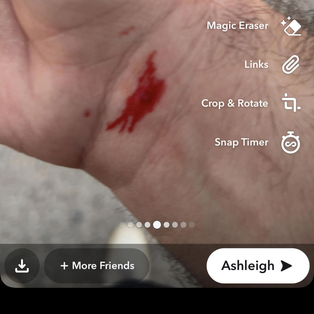 Open wounds (Explicit)