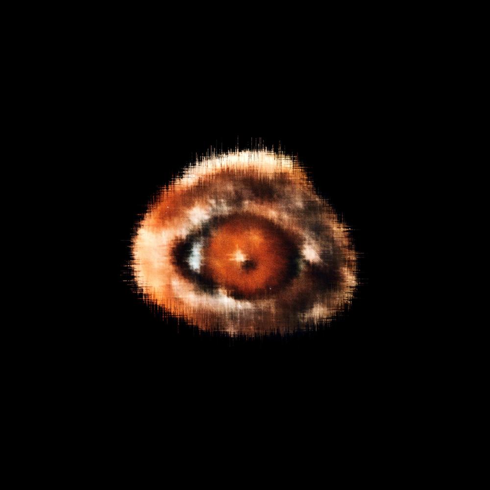 LUNGS, PART 2
