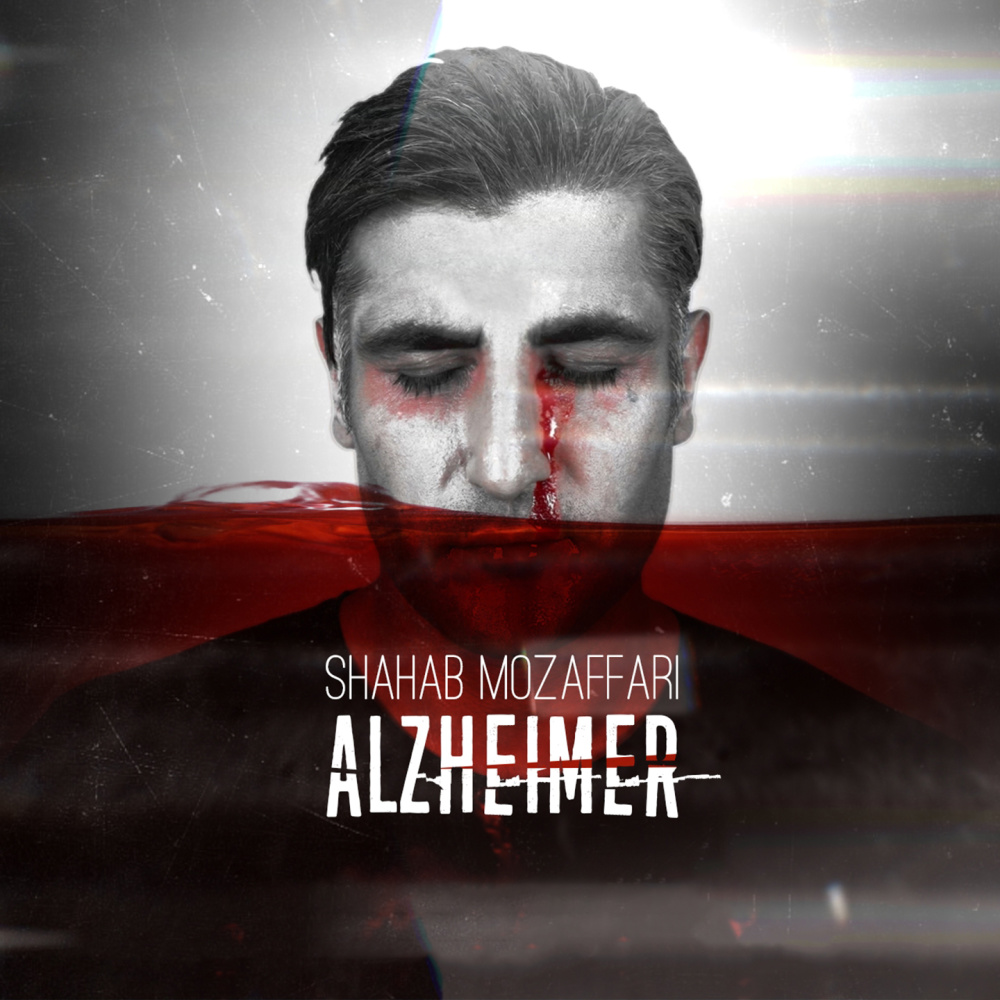 Alzheimer