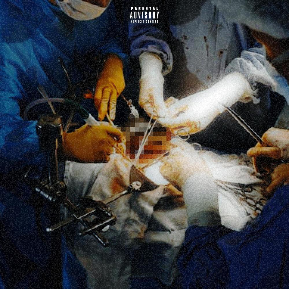 FORI (Explicit)