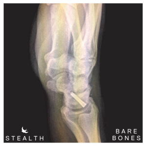 Stealth的專輯Bare Bones