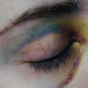 Idle Hands的專輯Bruises (Explicit)