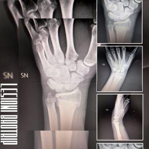 收聽Bad Trip的Lesioni (Explicit)歌詞歌曲