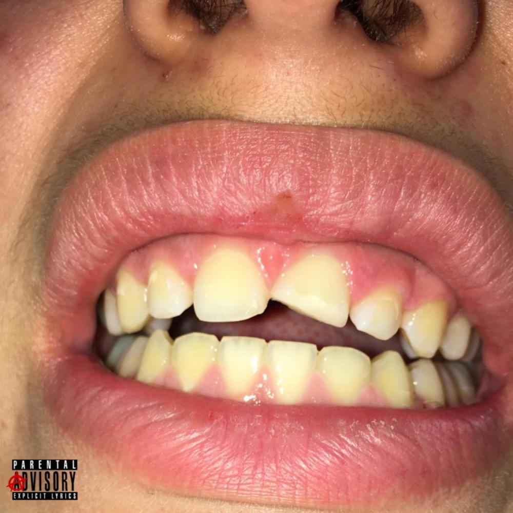 BROTHERS (feat. yung euphoria) (Explicit)