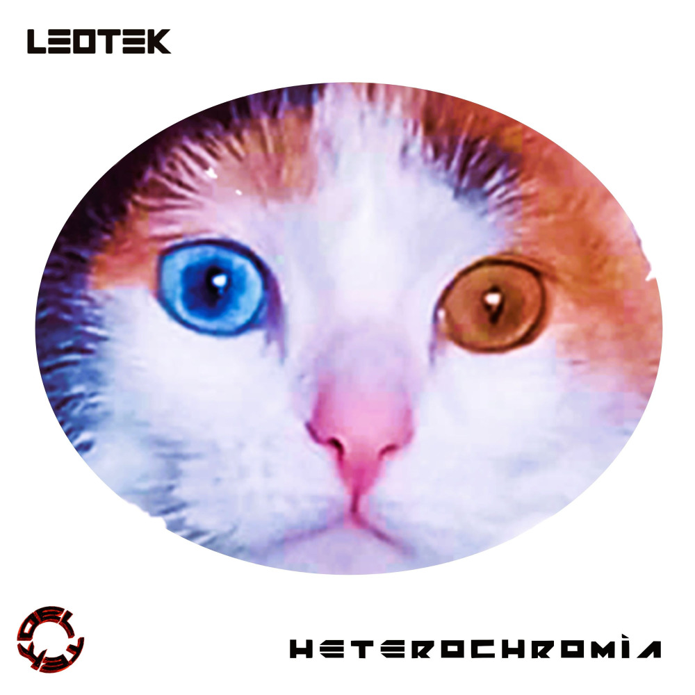 Heterochromia