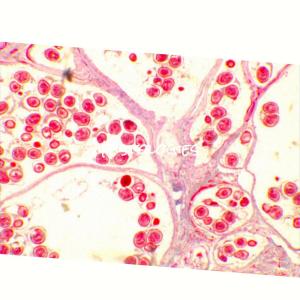 Album Histologies from Various