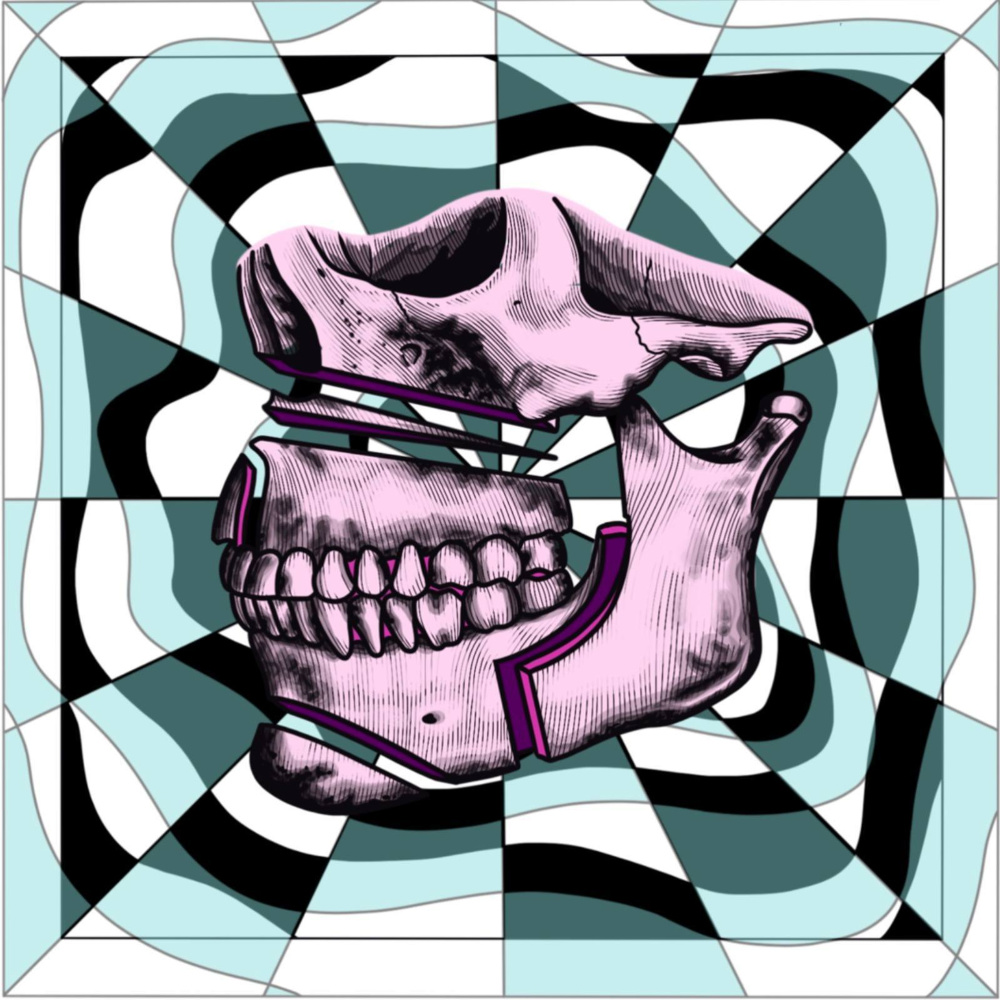 Jawbreaker