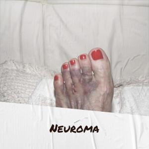 ดาวน์โหลดและฟังเพลง Shorty Pulverine พร้อมเนื้อเพลงจาก Napor Dith