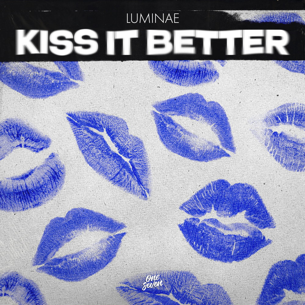 Kiss it Better