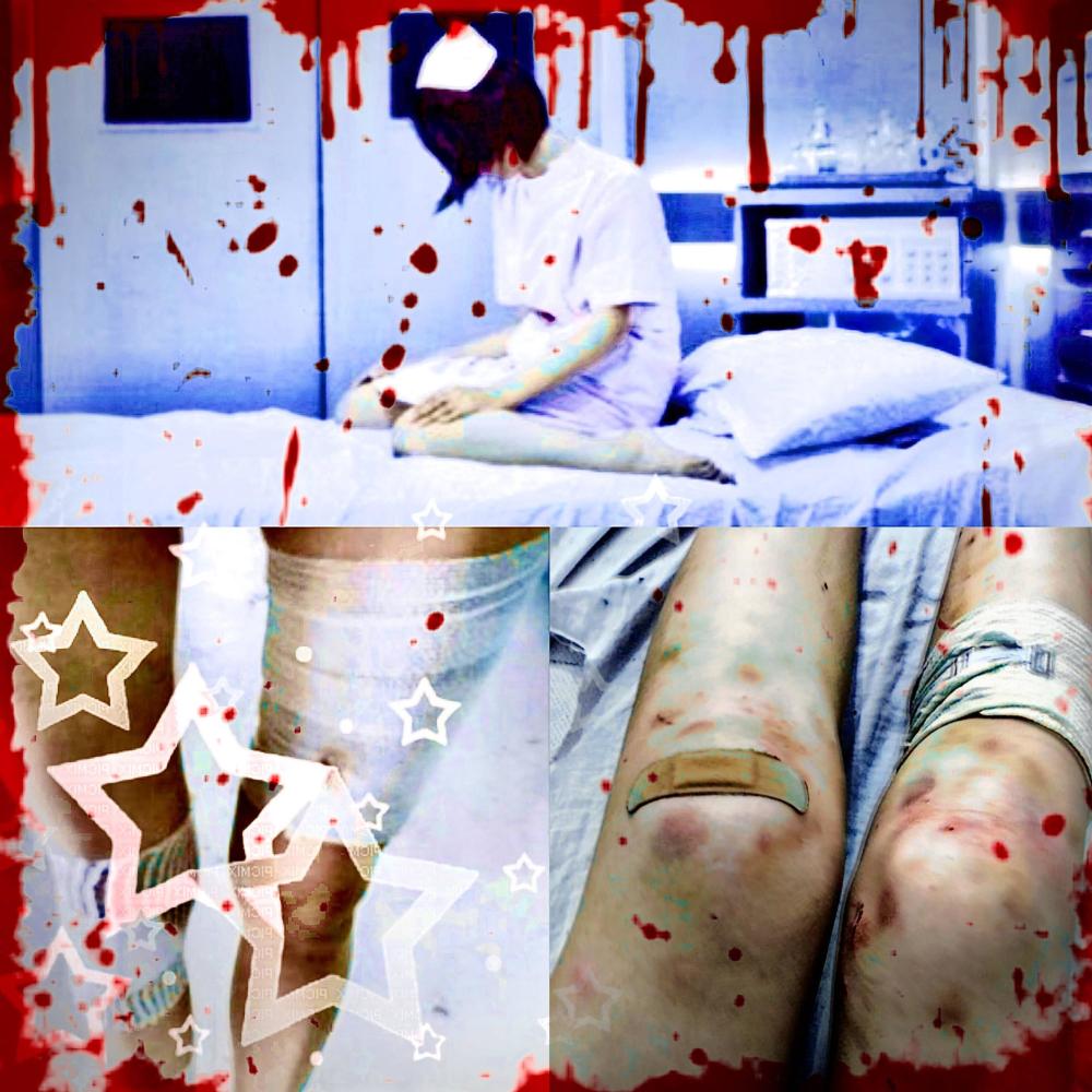 bruises (feat. hospital & syris) (Explicit)