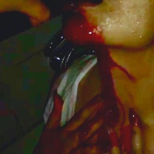 Album Blutbad (Explicit) from Acidsice