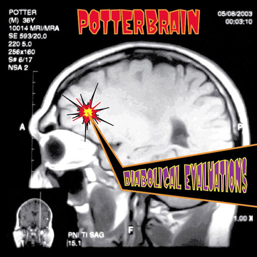 klinefelter's syndrome (Explicit)