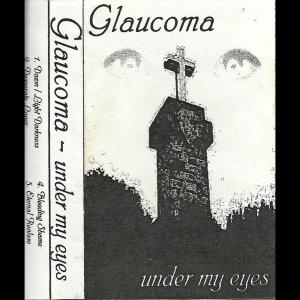 收聽Glaucoma的Desperate Lover歌詞歌曲