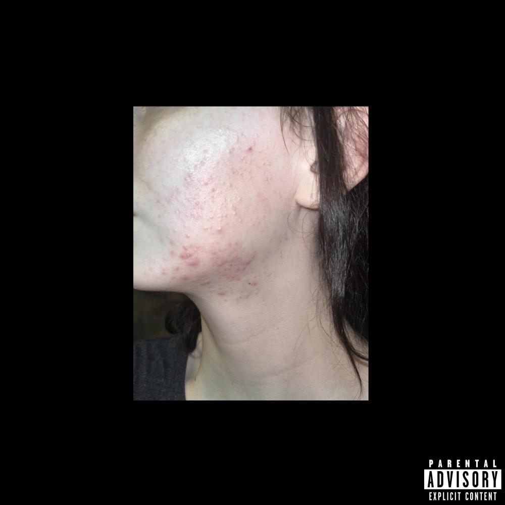 kansız (Explicit)