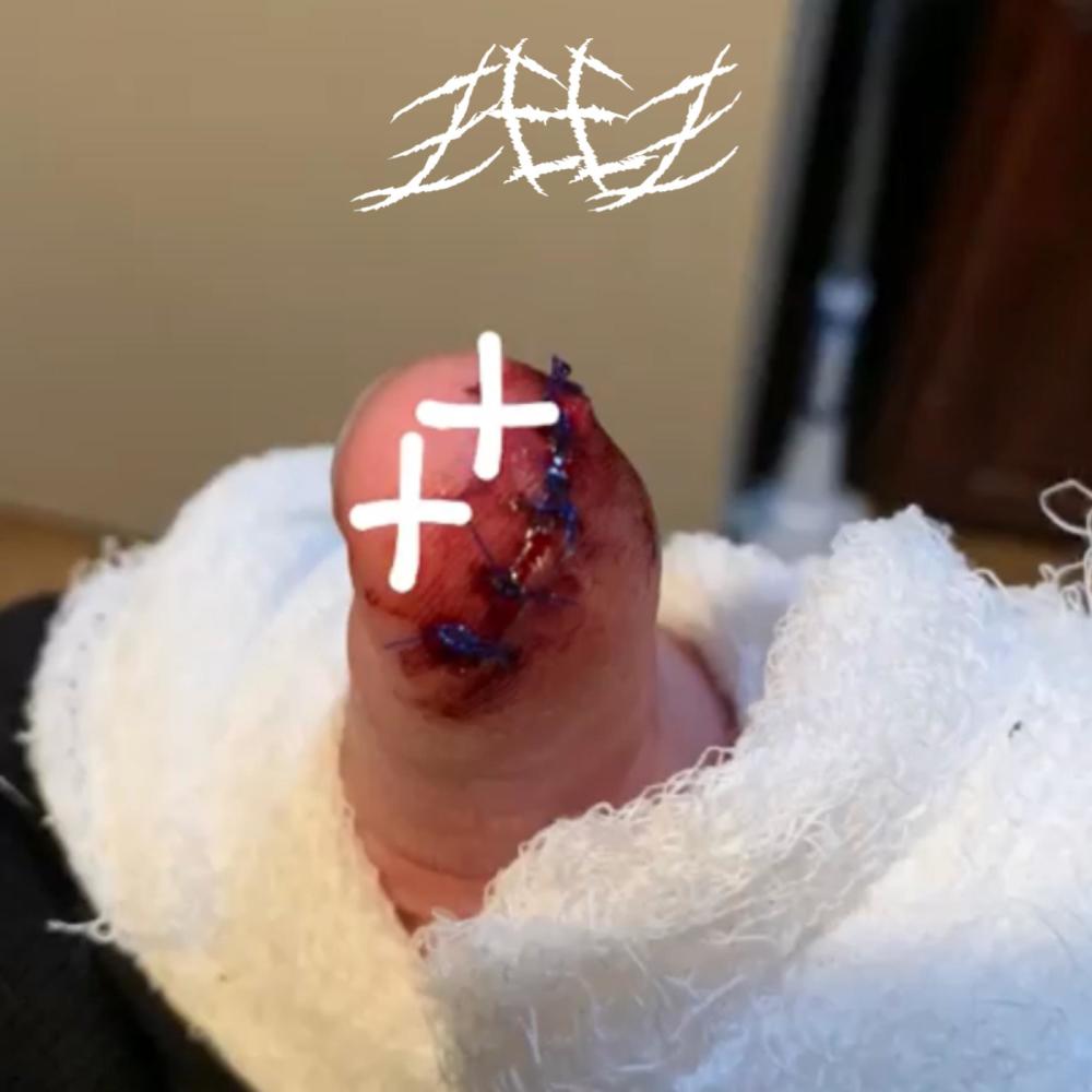 BLOODYNOSE! (Explicit)