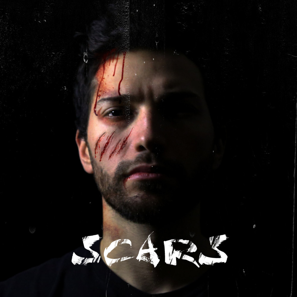 Scars