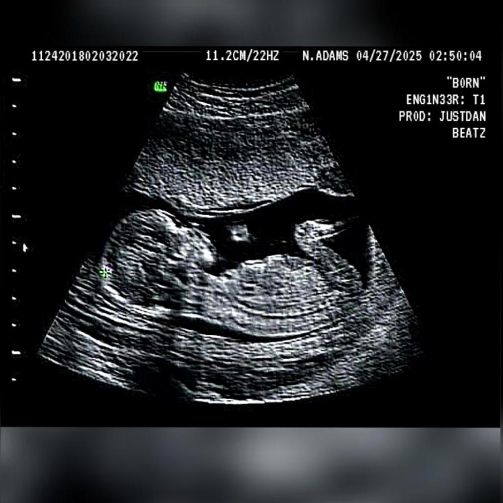 Born (Explicit)