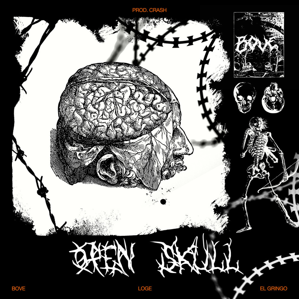 Open Skull (Explicit)