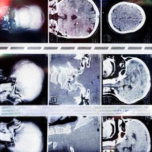 ดาวน์โหลดและฟังเพลง fading พร้อมเนื้อเพลงจาก BL1THE