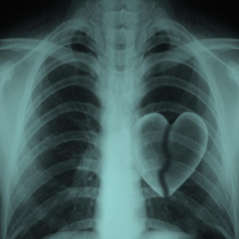 Broken Hearted