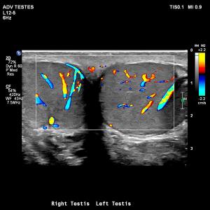 收聽Doin' Fine的EL NIÑO (Explicit)歌詞歌曲