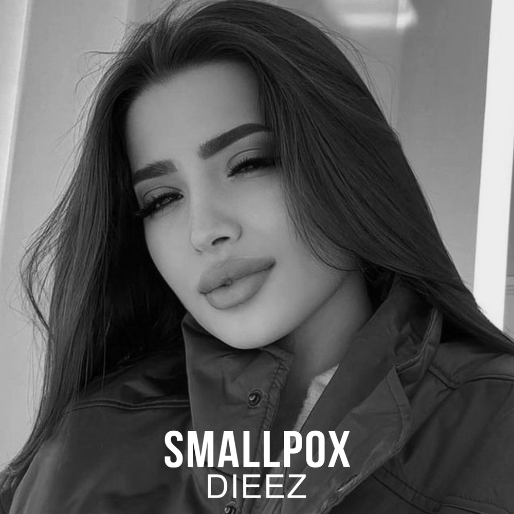 Smallpox