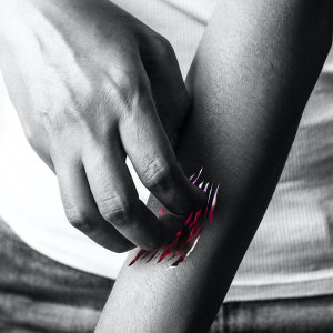 Listen to Itchy song with lyrics from Sumgii