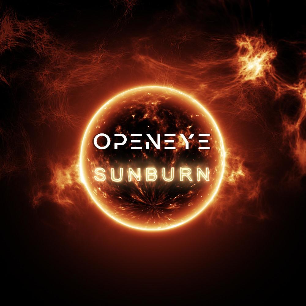 Sunburn