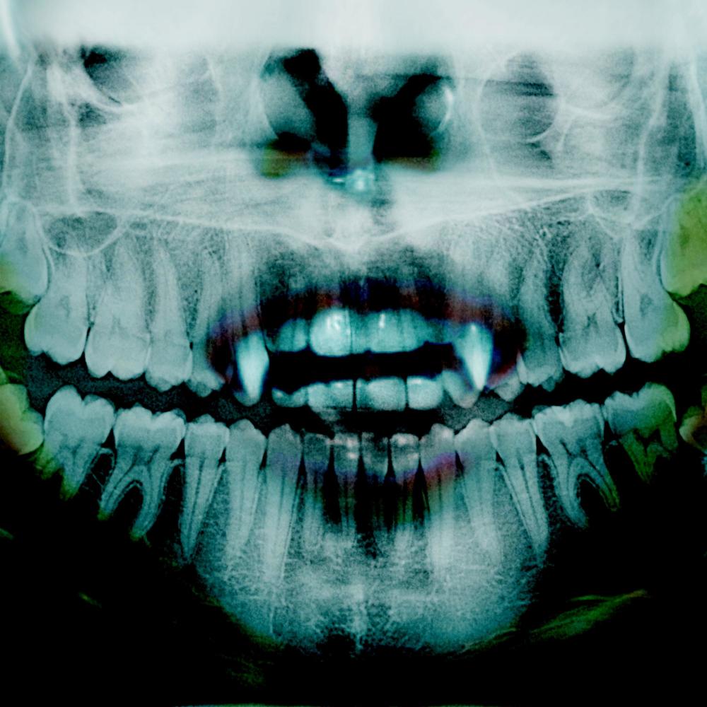 223 (Explicit)