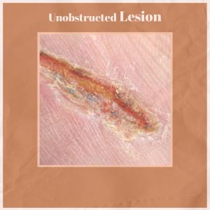 Album Unobstructed Lesion from Charne Lolla