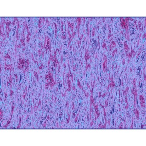 ดาวน์โหลดและฟังเพลง Laso พร้อมเนื้อเพลงจาก Iggy The Eskimo