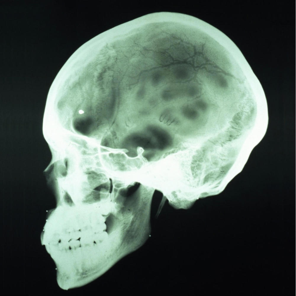 Red Dot (Head Crack) (Explicit)