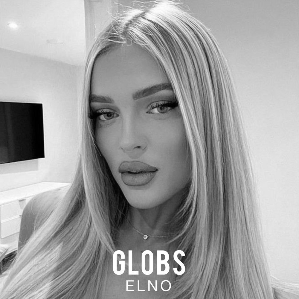 Globs