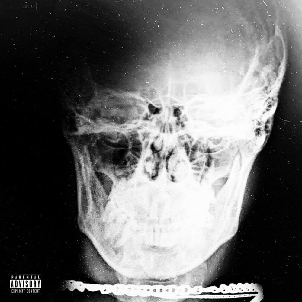 Хэдшот (Bonus|Explicit)