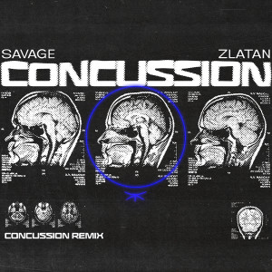 Zlatan的專輯Concussion (Remix) (Explicit)