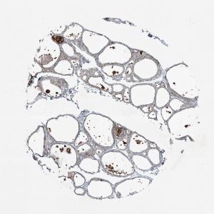 Dengarkan Apoptosis 1 lagu dari BrainDead dengan lirik