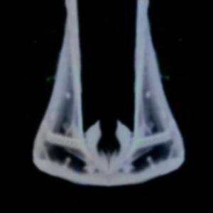 Aexhy的專輯ME WE PAIN