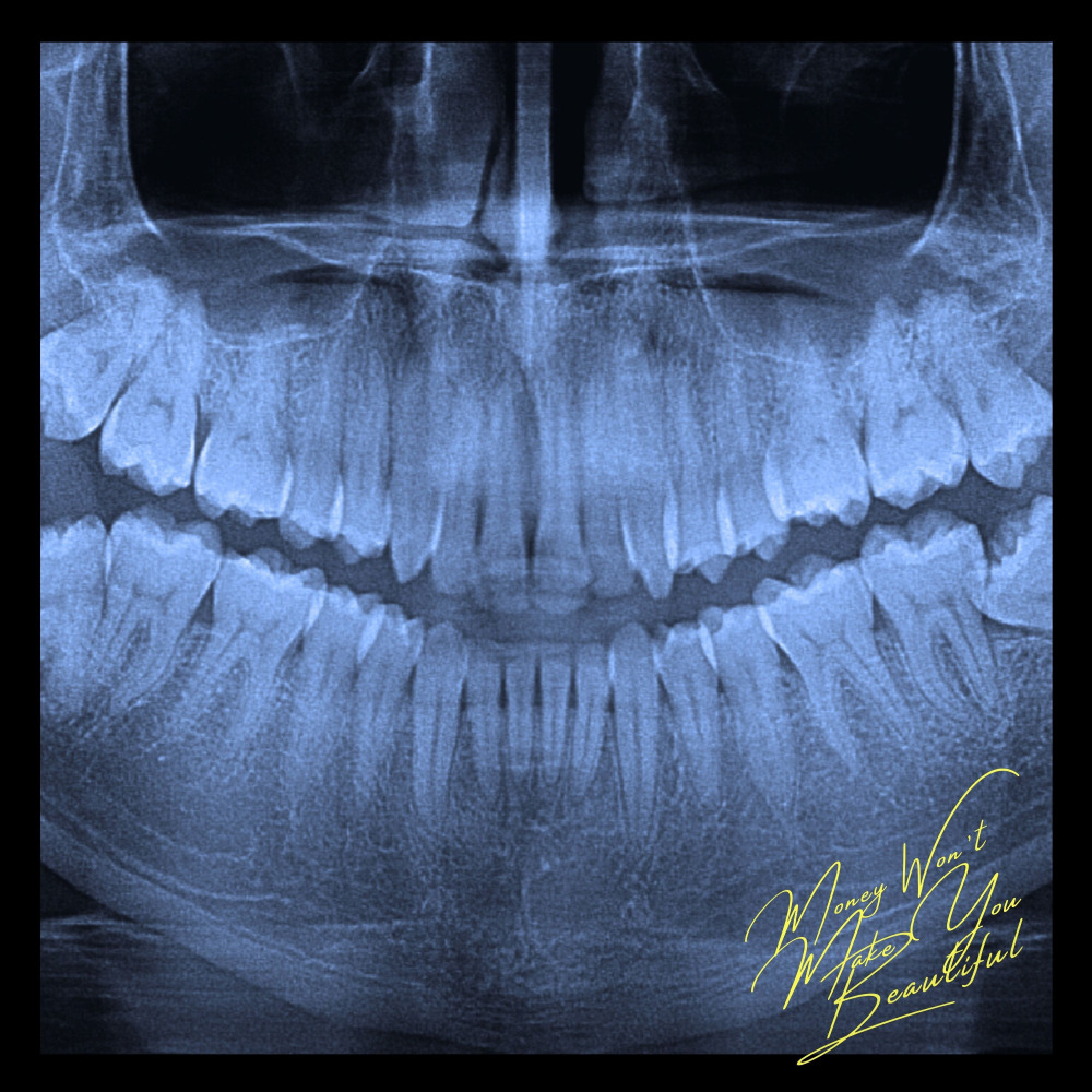 Beat Blocks (Explicit)