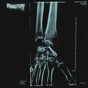 Tibi Dit Tcheck的專輯Fracture (Explicit)